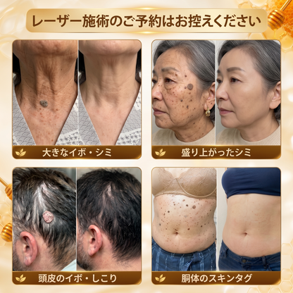 ✅ PLTOWE® 残りわずか5点！さらに30％OFFでご提供中！